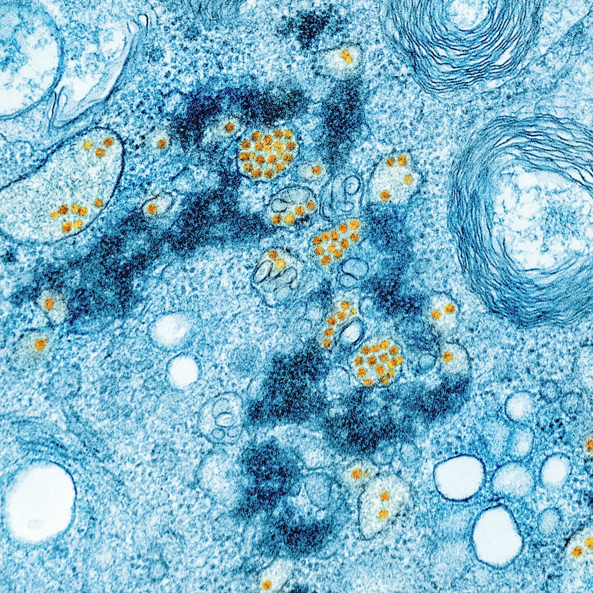 What Is Saccharomyces boulardii? Why Travellers Are Talking About This Unique Probiotic